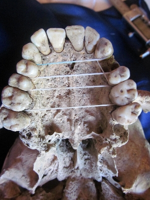 Vite corte ma denti sani: cosa ci raccontano i teschi del monastero di San Giorgio.